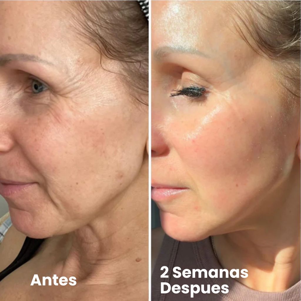 VitaPRO-Retinal Shot - Dile Adiós a las Arrugas 😱50% DE DESCUENTO😱